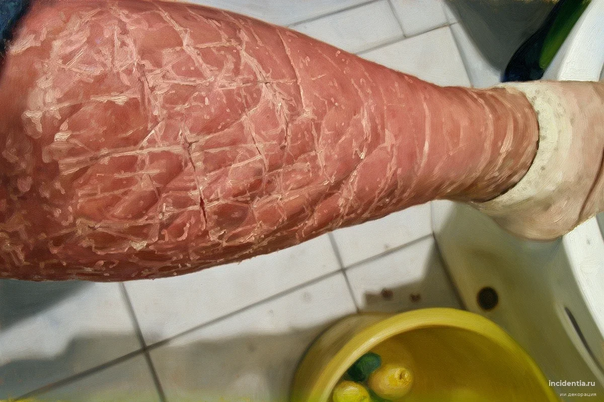 В Екатеринбурге таксист нажал на газ при виде редкой болезни пассажирки